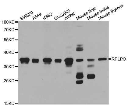 Western blot analysis of RPLP0 polyclonal antibody