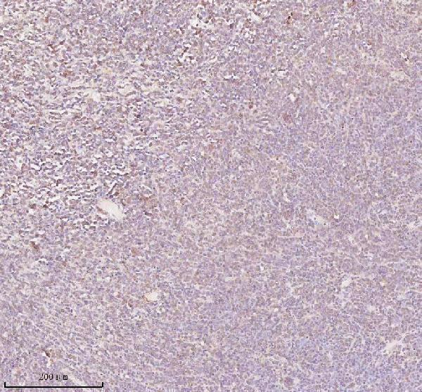  IHC analysis of ORC2 using anti-ORC2 antibody (A04350-1)