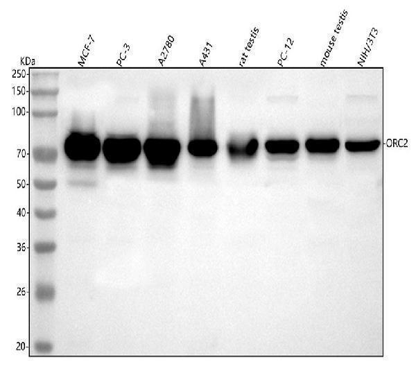  Western blot analysis of ORC2 using anti-ORC2 antibody (A04350-1)