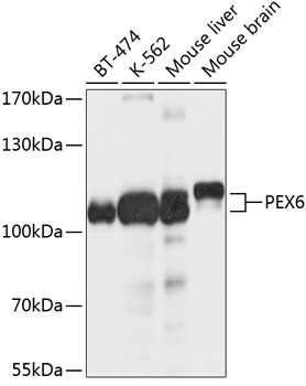 Western blot analysis of extracts of various cell lines, using PEX6 antibody  at 1:1000 dilution