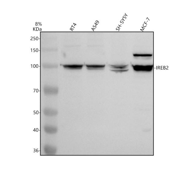 Western blot analysis of IREB2 using anti-IREB2 antibody (A04356-2)