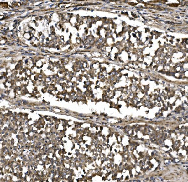 a04360 2 cisd1 primary antibodies ihc testing 2