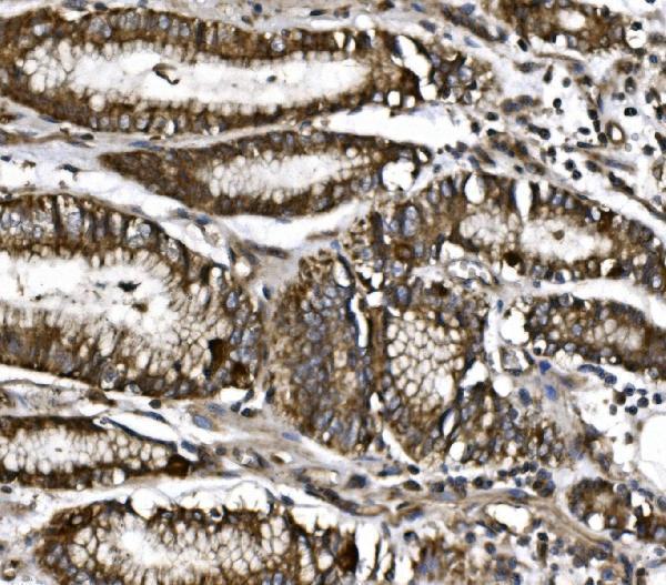 a04360 2 cisd1 primary antibodies ihc testing 3