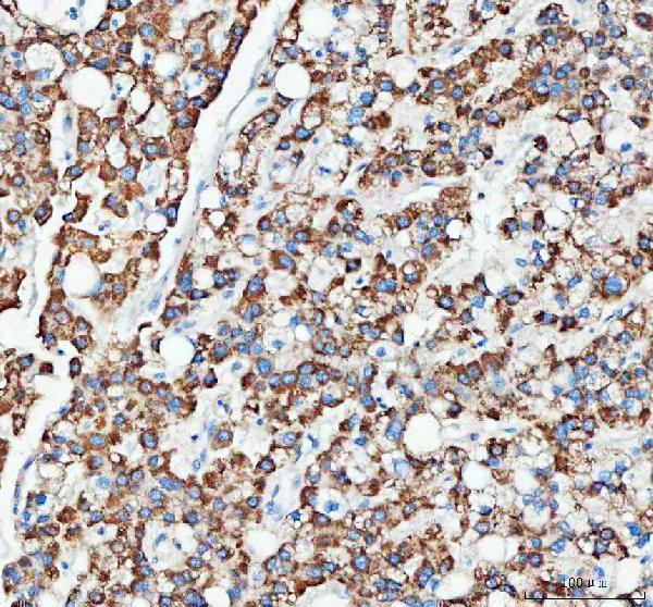  IHC analysis of OTUB1 using anti-OTUB1 antibody (A04361-1)