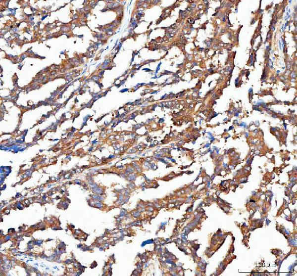  IHC analysis of OTUB1 using anti-OTUB1 antibody (A04361-1)
