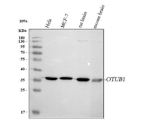  Western blot analysis of OTUB1 using anti-OTUB1 antibody (A04361-1)