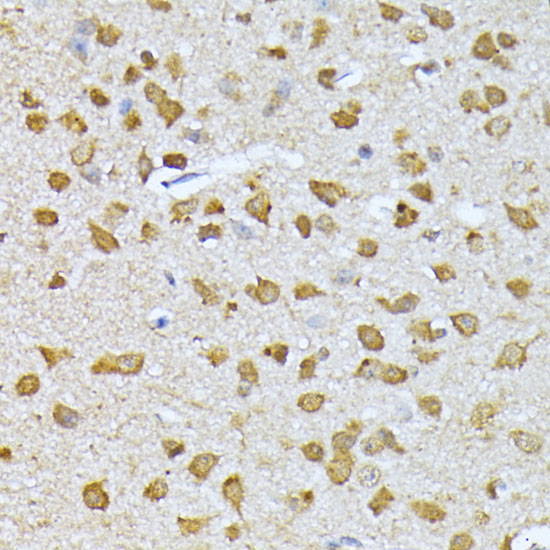a04363 rps27a primary antiboties ihc testing 4