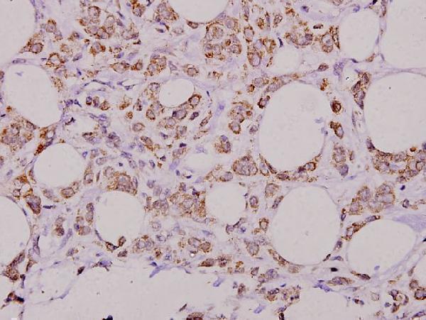 a04364 1 espl1 primary antiboties ihc testing 2