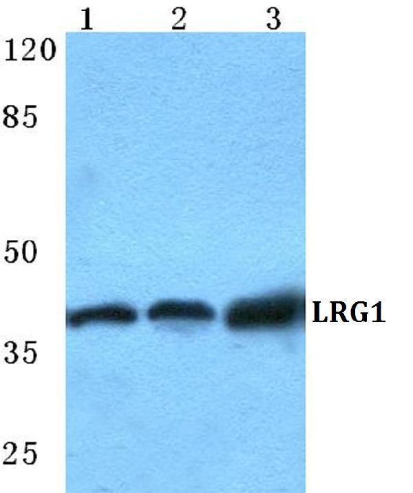 Western blot (WB) analysis of LRG1 polyclonal antibody at 1:500 dilution
Lane1:Hela cell lysate
Lane2:Raw264