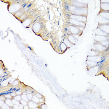 Immunofluorescence analysis of rat liver cells using LRG1 Rabbit pAb  at dilution of 1:100 