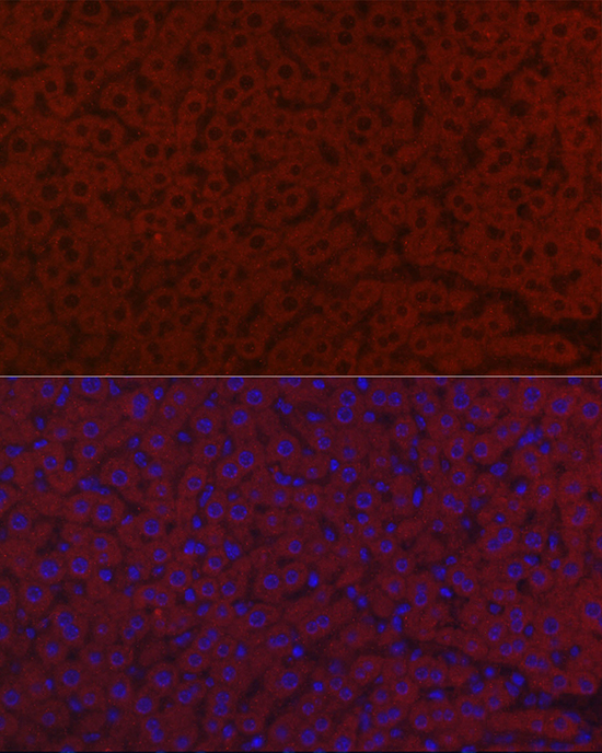 a04365 2 lrg1 primary antiboties if testing 4