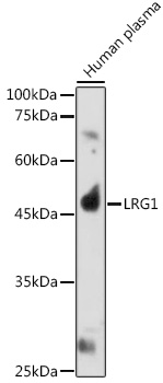 Western blot analysis of extracts of Human plasma, using LRG1 antibody  at 1:1000 dilution