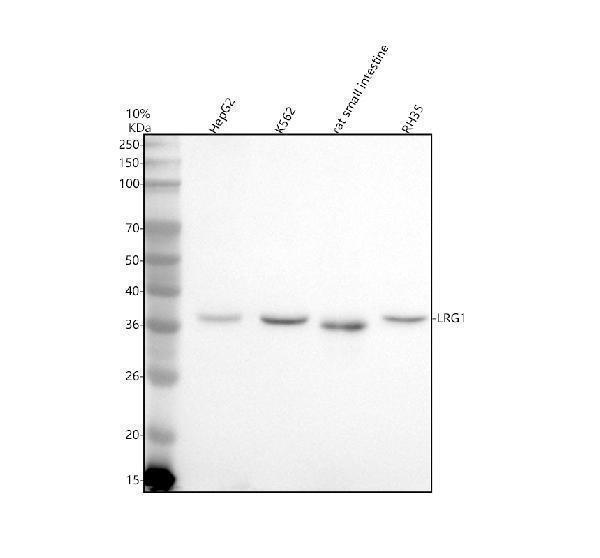  Western blot analysis of LRG1 using anti-LRG1 antibody (A04365-3)