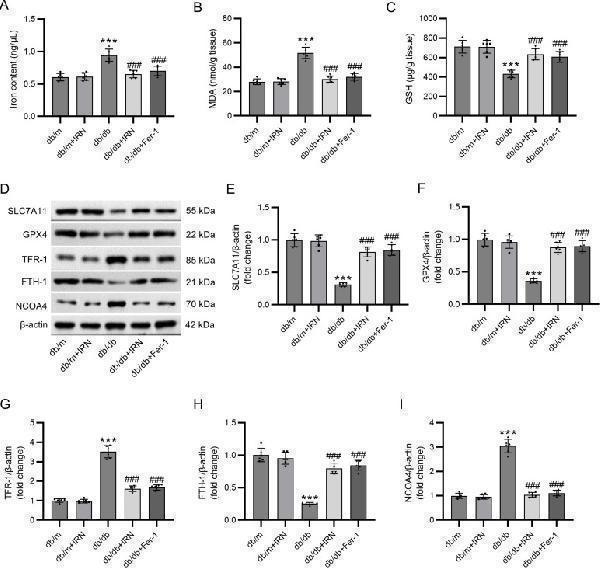 IRN inhibits ferroptosis in db/db mice