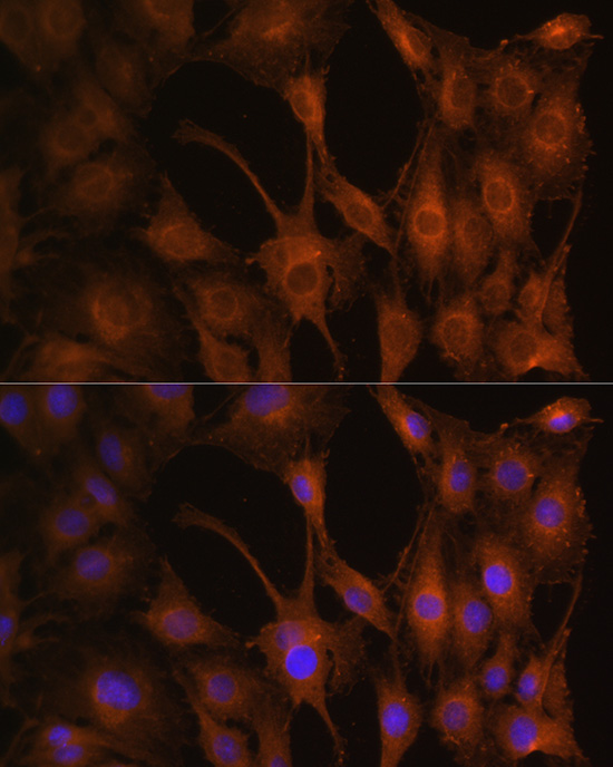 a04370 1 pfkm primary antiboties if testing 2