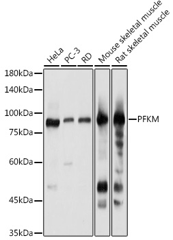a04370 1 pfkm primary antiboties wb testing 1