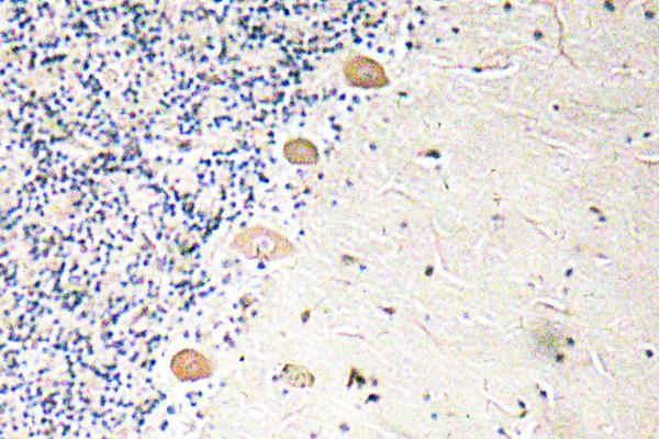 a04370 pfkm primary antibodies ihc testing 1