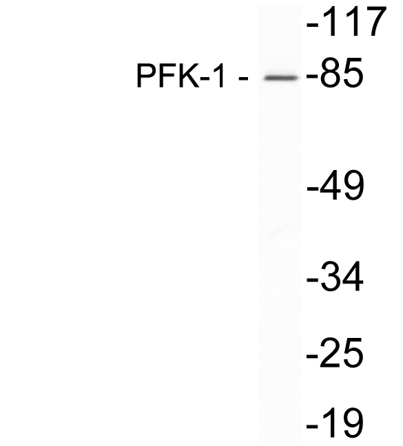 Western blot analysis of lysate from Hela cells, using PFK-1 antibody