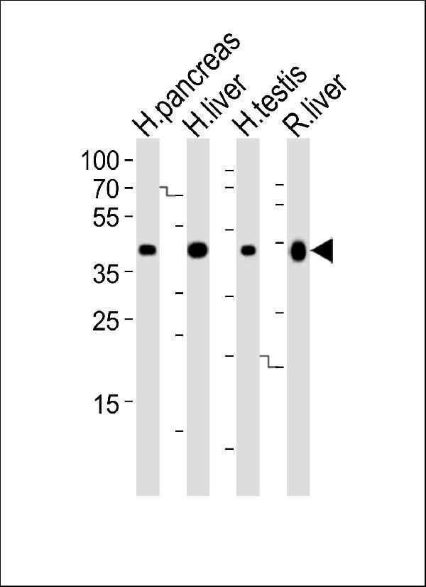Western blot analysis of lysates from human pancreas, liver, testis and rat liver tissue lysate (from left to right), using HMGCS2 Antibody (C-term)