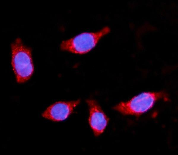 a04371 2 hmgcs2 primary antibodies if testing 6