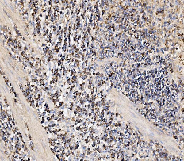  IHC analysis of HMGCS2 using anti-HMGCS2 antibody (A04371-2)