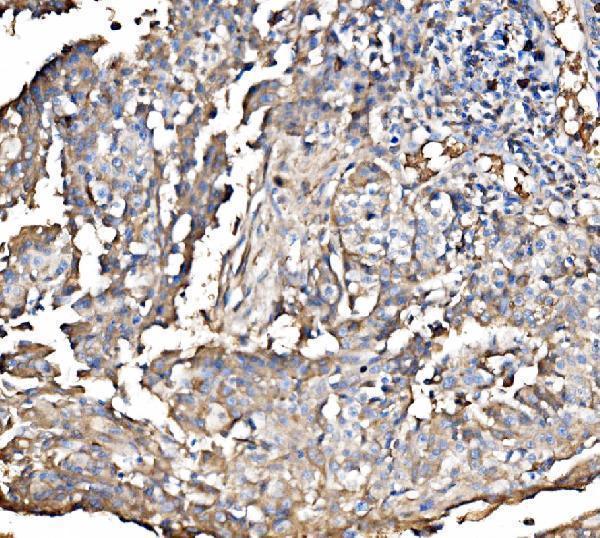  IHC analysis of HMGCS2 using anti-HMGCS2 antibody (A04371-2)