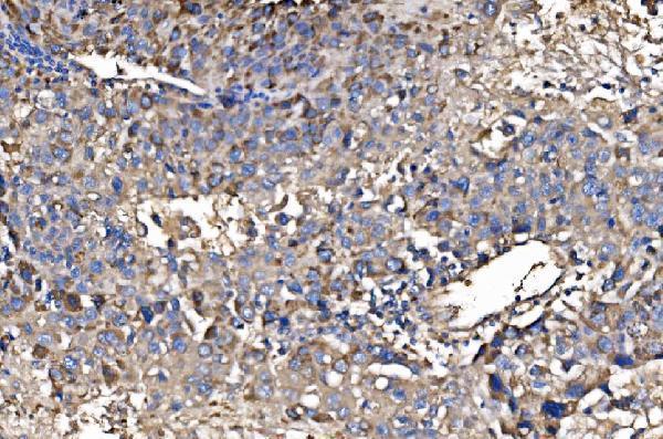 a04371 2 hmgcs2 primary antibodies ihc testing 4