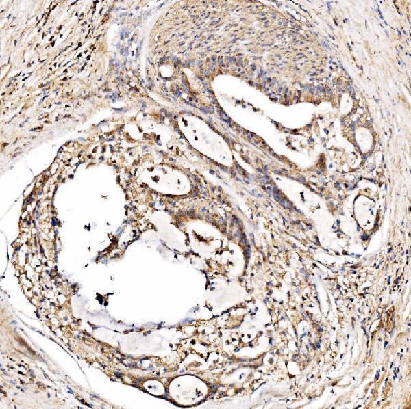 a04371 2 hmgcs2 primary antibodies ihc testing 5