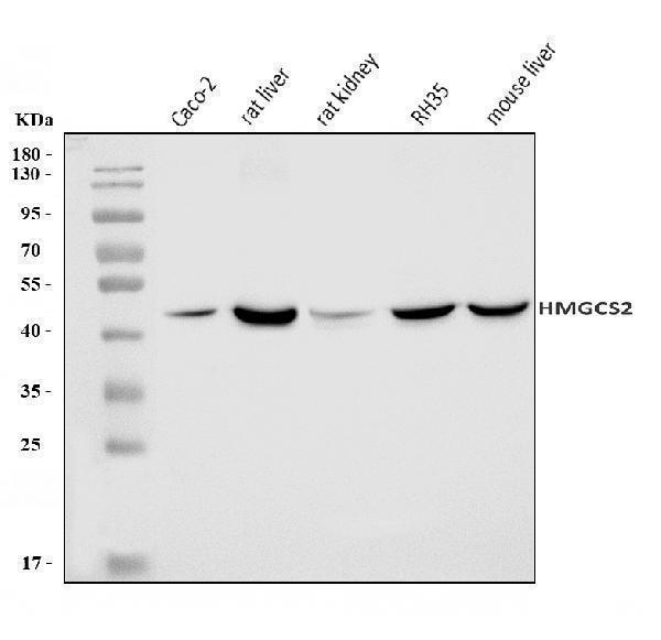  Western blot analysis of HMGCS2 using anti-HMGCS2 antibody (A04371-2)