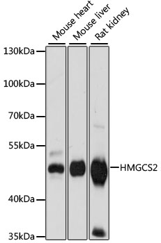 Western blot analysis of extracts of various cell lines, using HMGCS2 antibody  at 1:1000 dilution