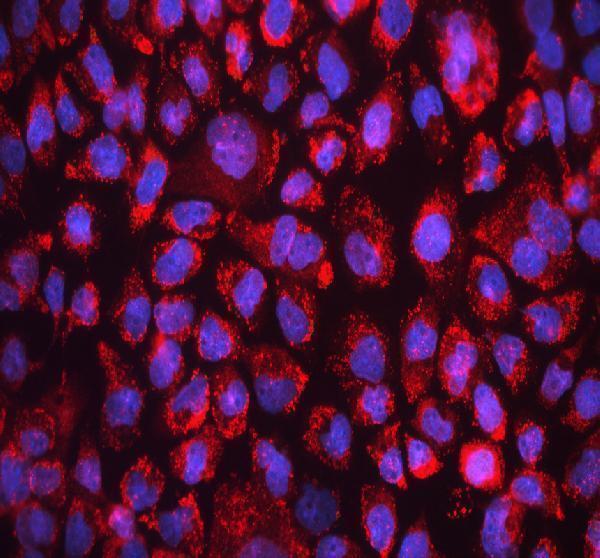 a04372 2 acsl4 primary antibodies if testing 4