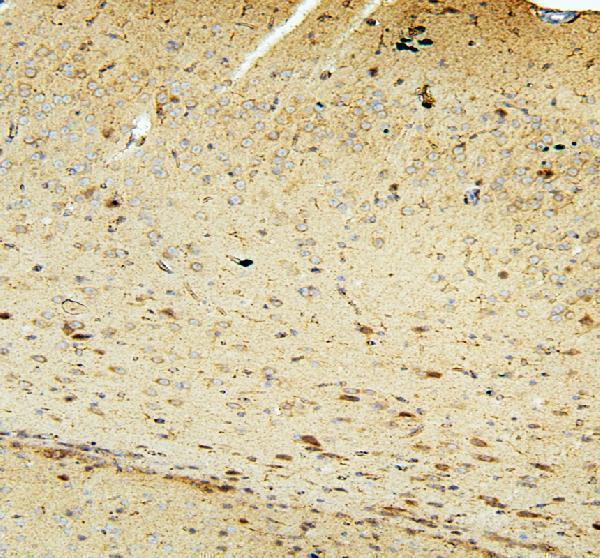  IHC analysis of FACL4/ACSL4 using anti-FACL4/ACSL4 antibody (A04372-2)