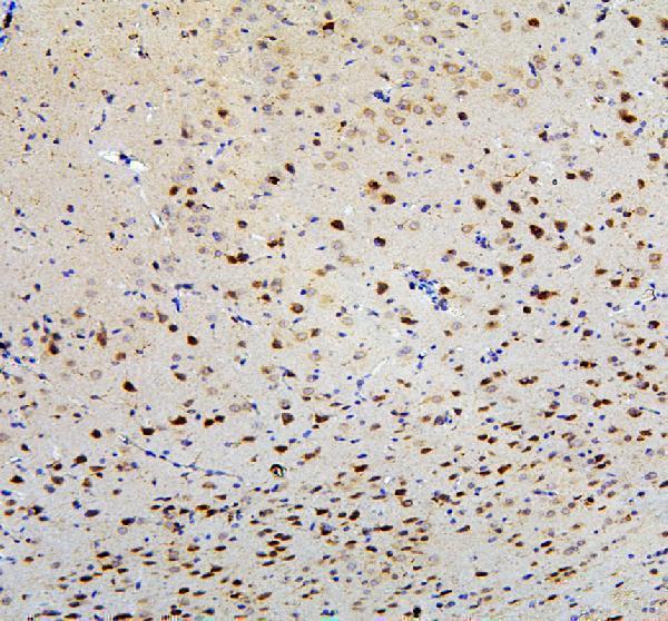 a04372 2 acsl4 primary antibodies ihc testing 3