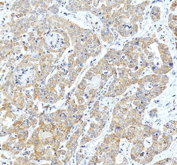IHC analysis of ACSL4/FACL4 using anti-ACSL4/FACL4 antibody (A04372-2)