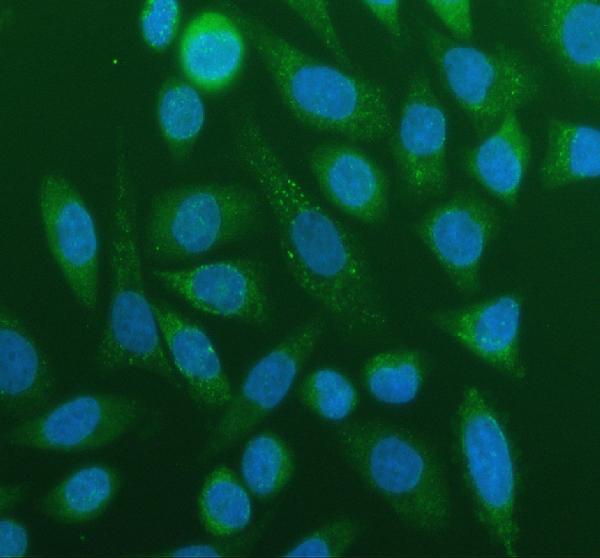 a04372 3 acsl4 primary antibodies if testing 1