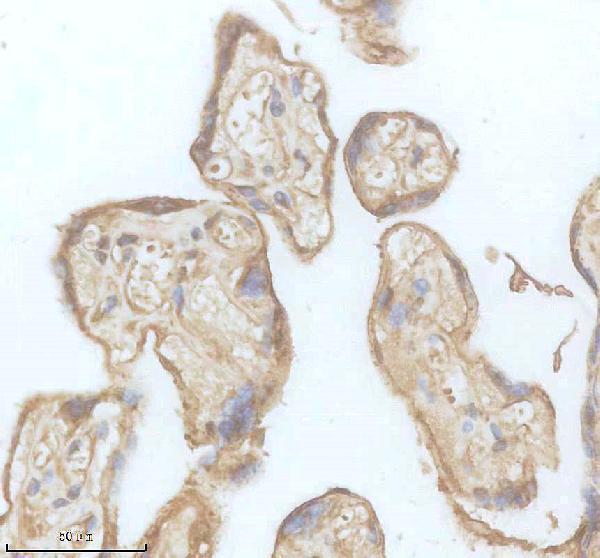 IHC analysis of DLG5 using anti-DLG5 antibody (A04374)