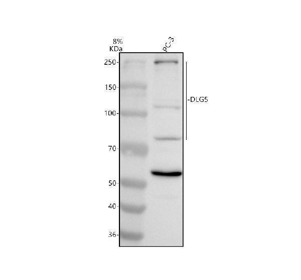 Western blot analysis of DLG5 using anti-DLG5 antibody (A04374)