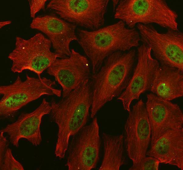 a04375 1 psme3 primary antibodies if testing 1