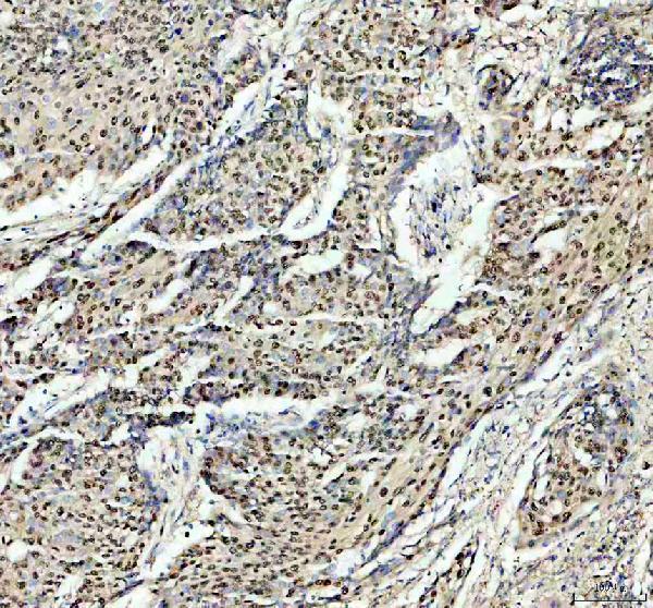 IHC analysis of PSME3 using anti-PSME3 antibody (A04375-1)