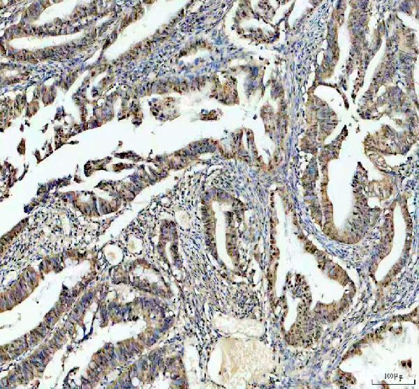 IHC analysis of PSME3 using anti-PSME3 antibody (A04375-1)