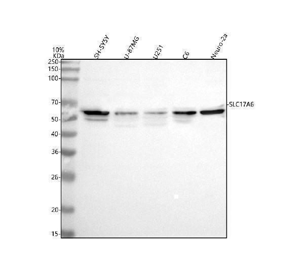  Western blot analysis of VGLUT2/SLC17A6 using anti-VGLUT2/SLC17A6 antibody (A04376-1)