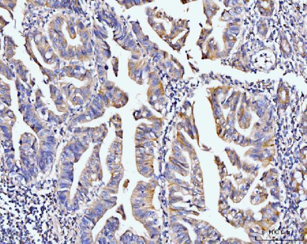 a04377 1 pdlim7 primary antibodies ihc testing 4