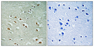 a04379 1 crem primary antibodies ihc testing 1