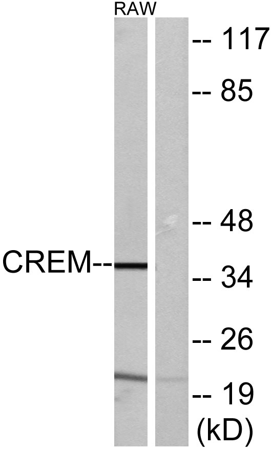 a04379 1 crem primary antibodies wb testing 2