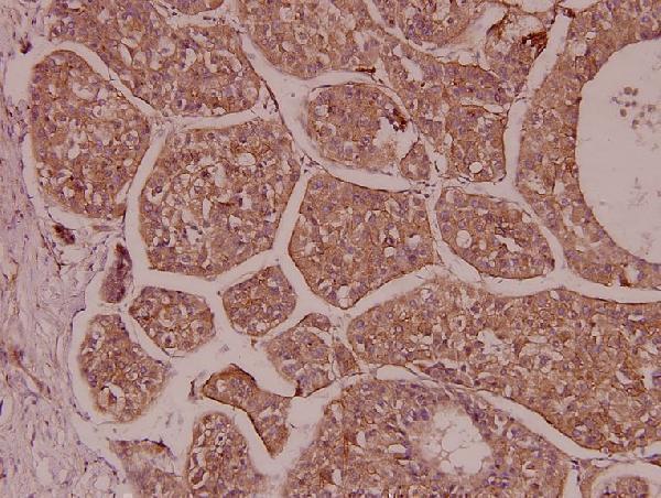 a04379 crem primary antiboties ihc testing 2