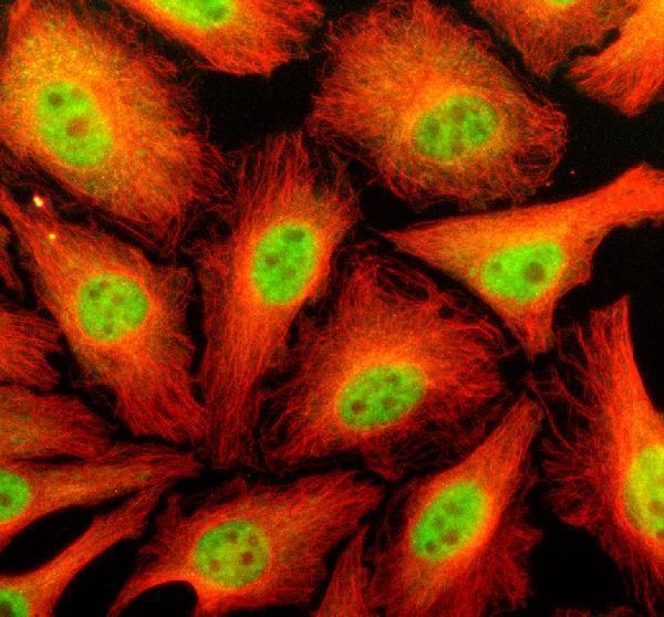 a04382 2 rbbp6 primary antibodies if testing 1