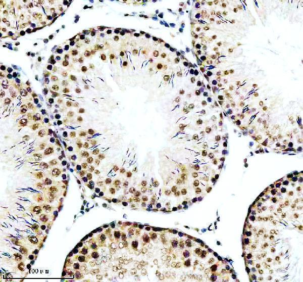 a04382 2 rbbp6 primary antibodies ihc testing 1