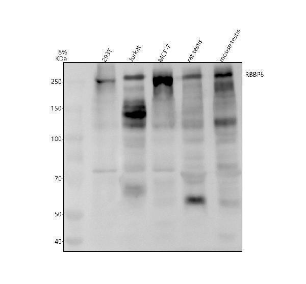 a04382 2 rbbp6 primary antibodies wb testing 1