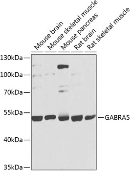 a04383 1 gabra5 primary antiboties wb testing 1