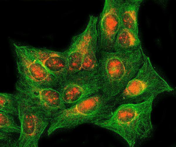  IF analysis of RASSF2 using anti-RASSF2 antibody (A04384-1) and anti-Tubulin Alpha antibody (M03989-3)